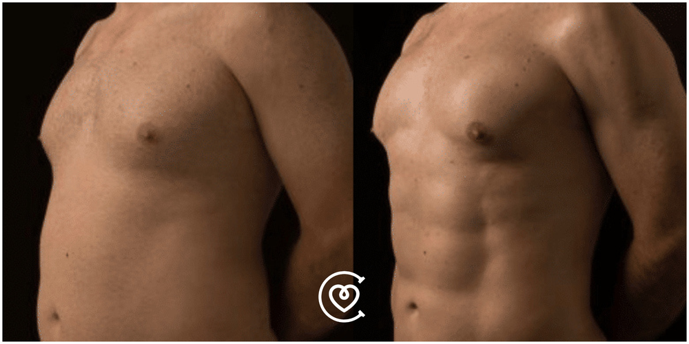 Before and After Result